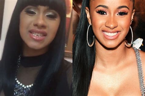 Did Cardi B Get Plastic Surgery? Exploring the Rumors and Realities